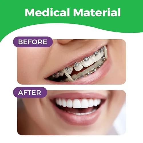 Prairie Horse Supply Orthodontic Rubber Bands for Braces, 1/4in Medium, 300 Pack | Versatile & Durable thumbnail 5