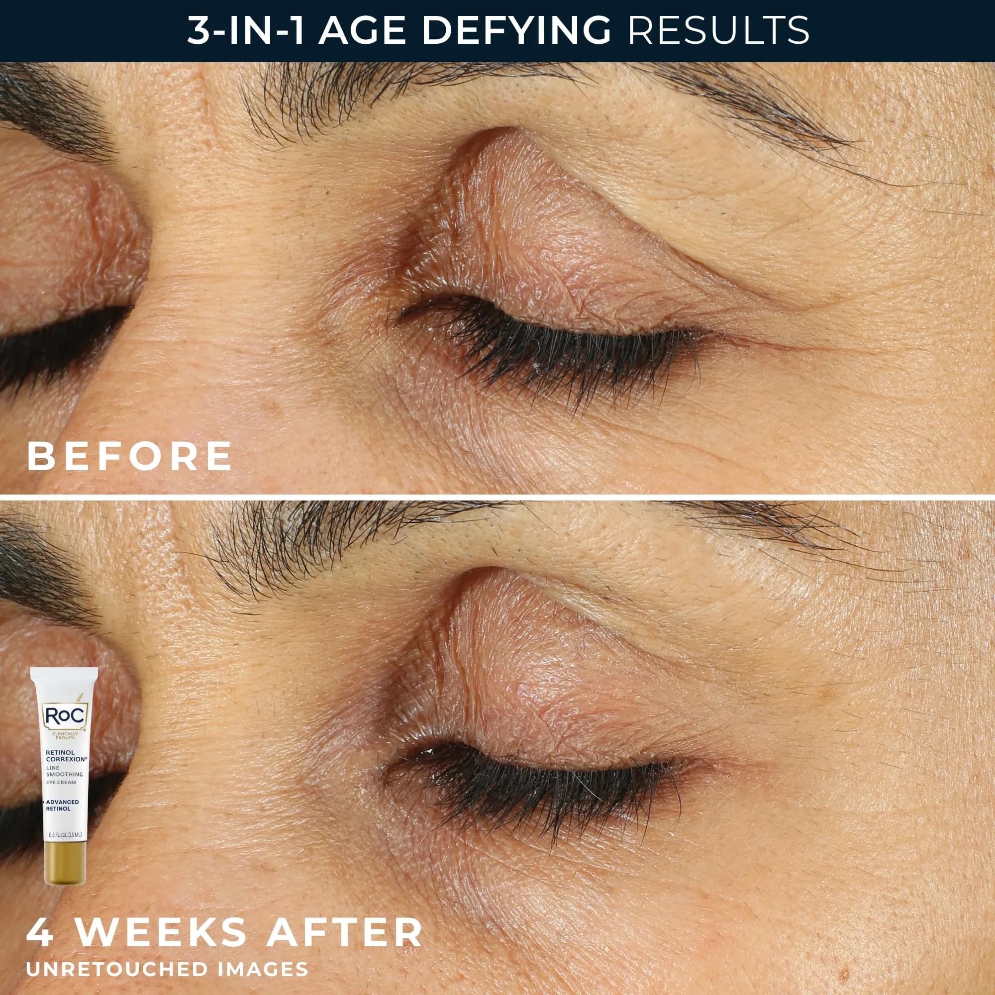 RoC Retinol Correxion Eye Cream & Night Cream Duo Value Set | Targets Puffiness, Dark Circles & Wrinkles - view 4