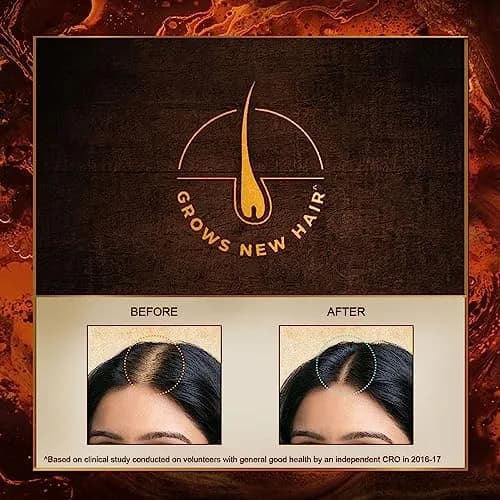 Indulekha Bringha Hair Oil 100ml (3.38 Fl Oz) | Ayurvedic Hair Fall & Dandruff Control thumbnail 4