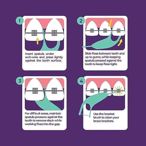 Platypus Orthodontic Flossers for Braces, 180 Count (Pack of 6) | Orthodontist Recommended for Braces thumbnail 3