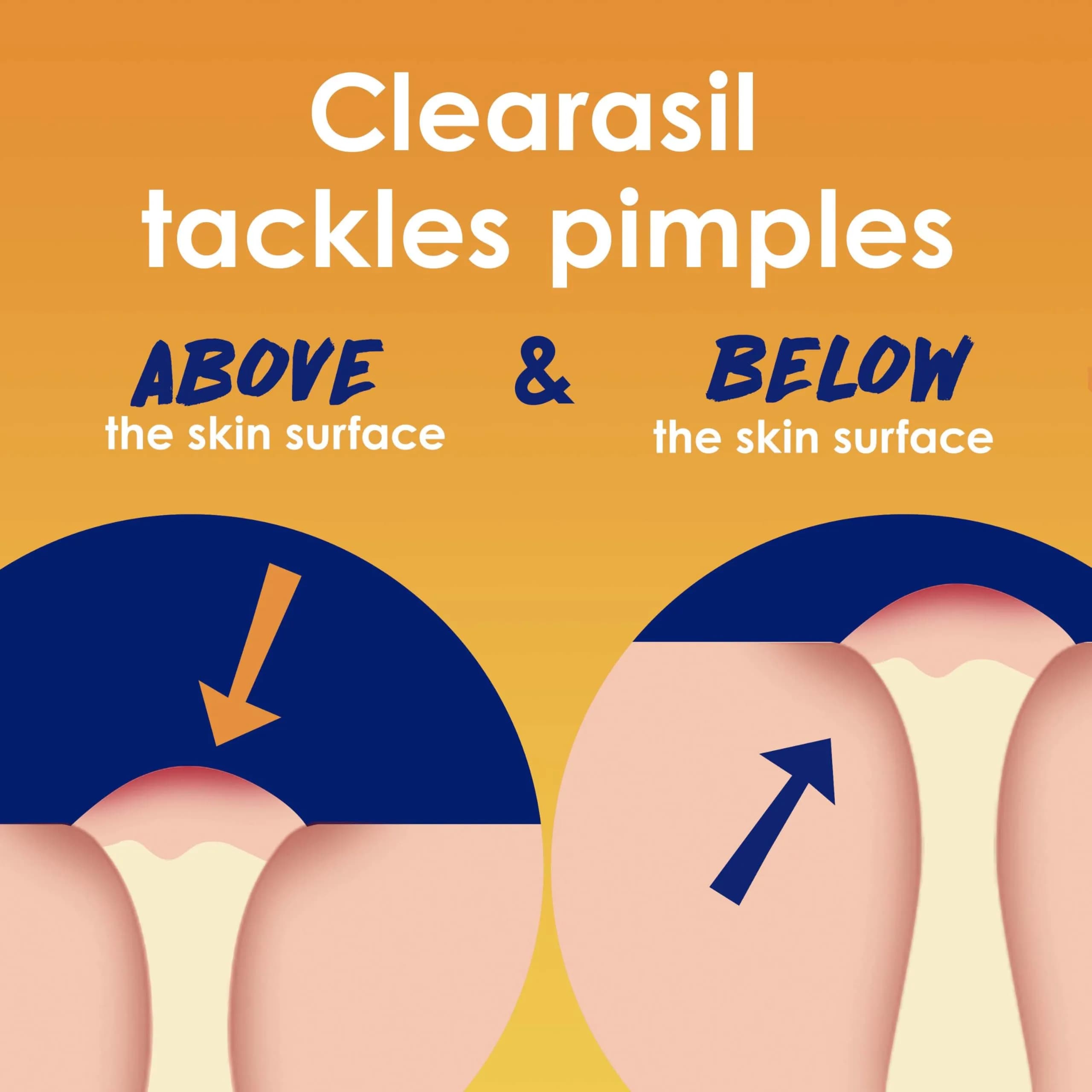 Clearasil Stubborn Acne Control 5in1 Daily Facial Cleansing Pads with Salicylic Acid 90 Count - view 3