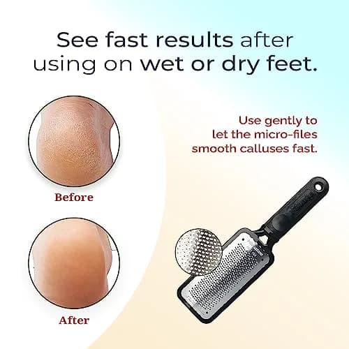 Microplane Foot Scraper White | Stainless Steel Dead Skin Remover for Feet thumbnail 5