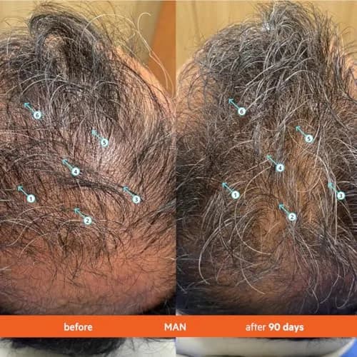 DS Labs Revita Hair Density Shampoo for Thinning Hair, Color Safe, 925 mL (31 Fl Oz) | Supports Scalp Wellness & Fuller-Looking Hair thumbnail 5