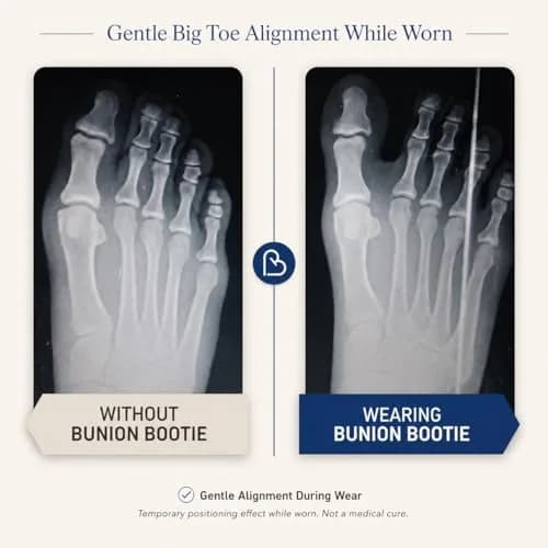 Bunion Bootie Big Toe Corrector Sleeve for Women & Men | Ultra-Thin, Breathable, Non-Surgical Support thumbnail 4