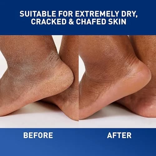CeraVe Healing Ointment 5oz | Skin Protectant for Dry & Eczema-Prone Skin thumbnail 5