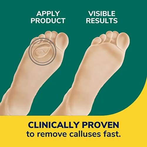 Dr. Scholl's Callus Remover Seal & Heal Bandage 4ct | Clinically Proven Fast Removal & All-Day Pain Relief thumbnail 3