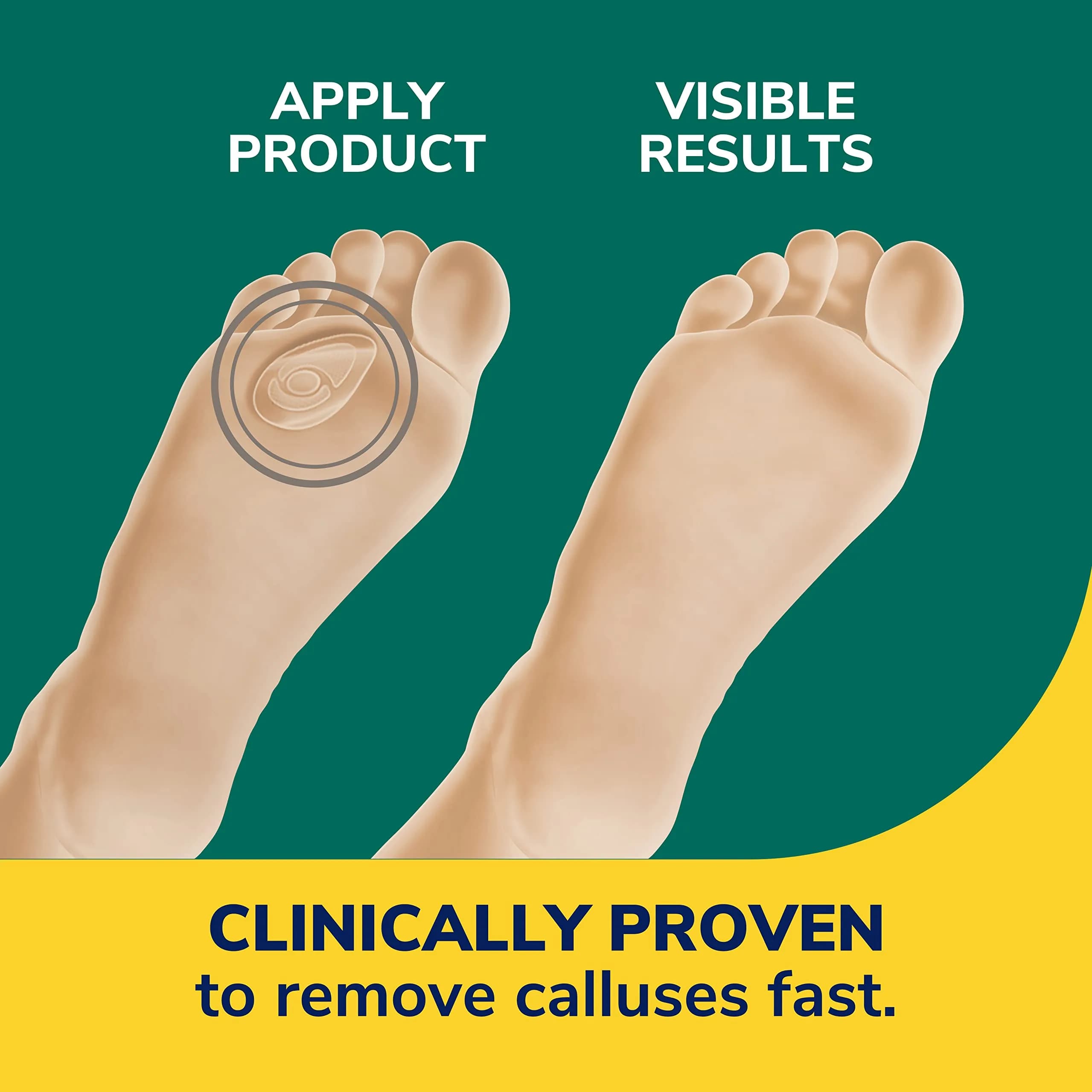 Dr. Scholl's Callus Remover Seal & Heal Bandage 4ct | Clinically Proven Fast Removal & All-Day Pain Relief - view 3