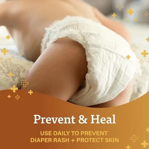 A+D Original Diaper Rash Ointment 44ml (1.5 Fl Oz) | Seals Out Wetness, Prevents Diaper Rash thumbnail 3