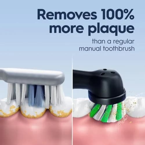 Oral-B Pro 1000 Rechargeable Electric Toothbrush Black 1 Count (Pack of 1) | Dentist-Recommended Cleaning thumbnail 3
