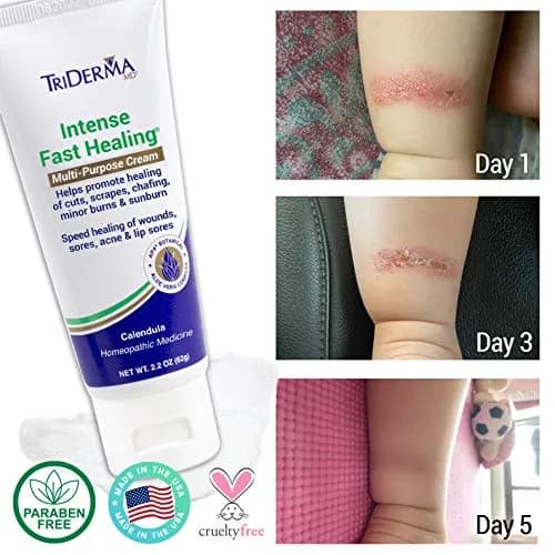 TriDerma Intense Fast Skin Healing Cream 2.2 oz | All-Purpose Skin Repair for Sensitive Skin thumbnail 6