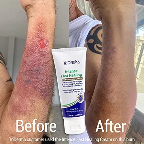 TriDerma Intense Fast Skin Healing Cream 2.2 oz | All-Purpose Skin Repair for Sensitive Skin thumbnail 2