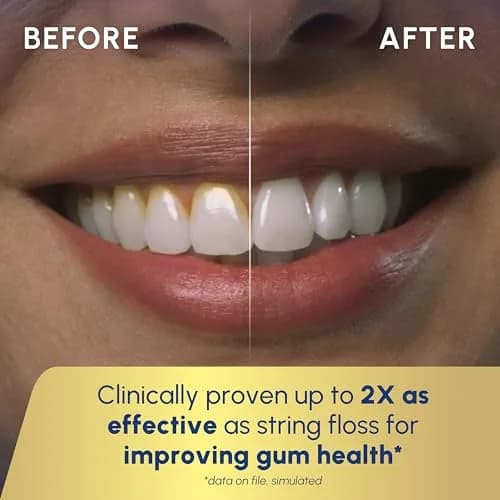 Waterpik Cordless Advanced Portable Water Flosser, Rechargeable, Blue | ADA Accepted Oral Irrigator for Gum Health thumbnail 5