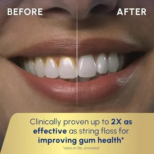 Waterpik Cordless Advanced Water Flosser WP-580 White | ADA Accepted Oral Irrigator for Travel & Daily Use thumbnail 5