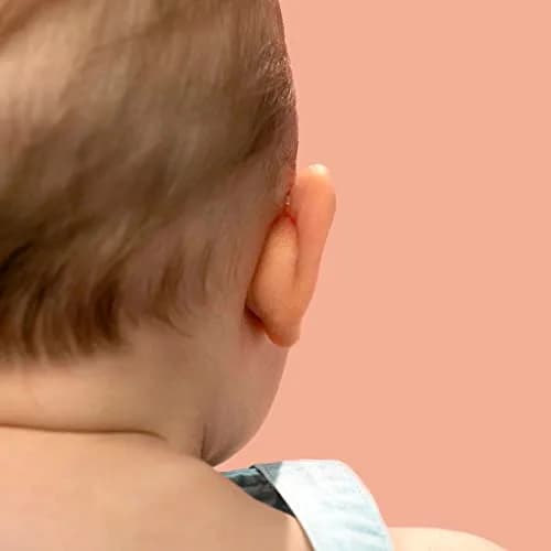 Otostick Baby Ear Corrector 8 Count Transparent Silicone | Corrects Prominent Ears from 3 Months thumbnail 5