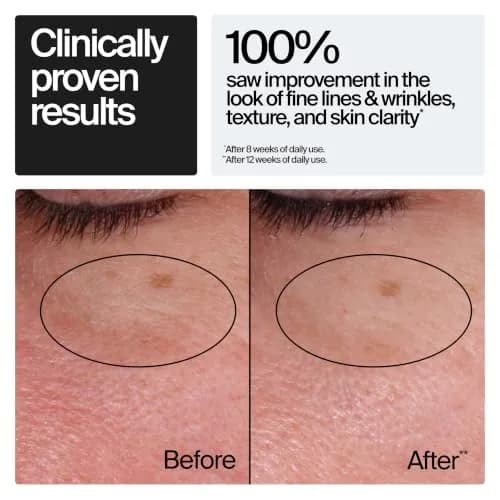 Neutrogena Rapid Wrinkle Repair Retinol Face Moisturizer 1.7 oz (50 ml) | Dermatologist Recommended Anti-Aging Cream thumbnail 3