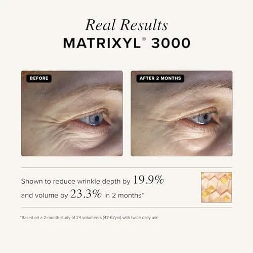 Asterwood Matrixyl 3000 & Argireline Peptide Serum with Hyaluronic Acid | Anti-Aging, 8 Fl Oz thumbnail 5