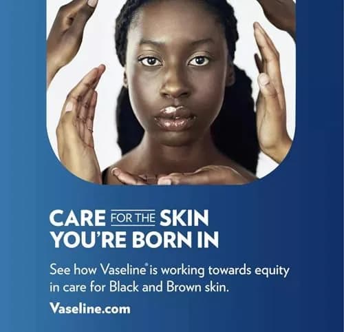 Vaseline Lip Therapy Original Mini 7g (0.25 Oz) Pack of 7 | Locks in Moisture for Soft, Smooth Lips thumbnail 6