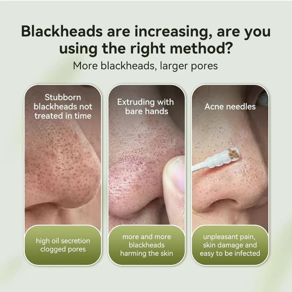 LANBENA Blackhead Remover Mask Charcoal Peel Off Mask 125ml (4.23 Fl Oz) | Deep Cleansing Pore Minimizer - view 6