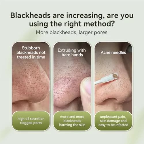 LANBENA Blackhead Remover Mask Charcoal Peel Off Mask 125ml (4.23 Fl Oz) | Deep Cleansing Pore Minimizer thumbnail 6