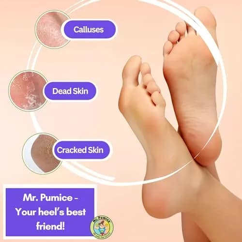 Mr. Pumice Ultimate PUMI Bar 2-in-1 Dual Grit (Medium + Coarse) Callus Remover for Feet & Heels | 4 Pack thumbnail 5