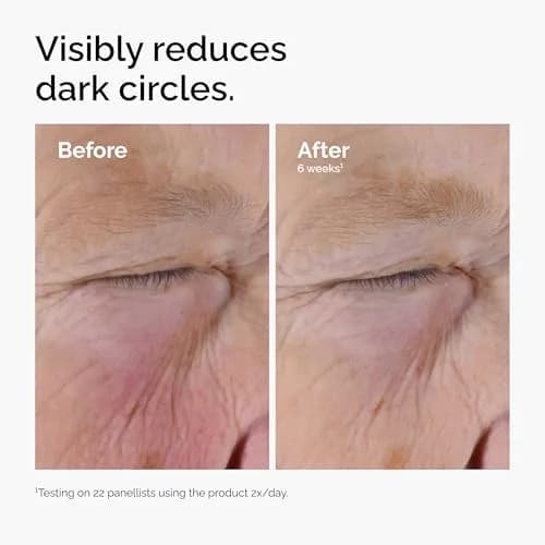 The Ordinary Caffeine Solution 5% + EGCG Eye Serum 30ml (1 Fl Oz) | Reduces Puffiness & Dark Circles thumbnail 5