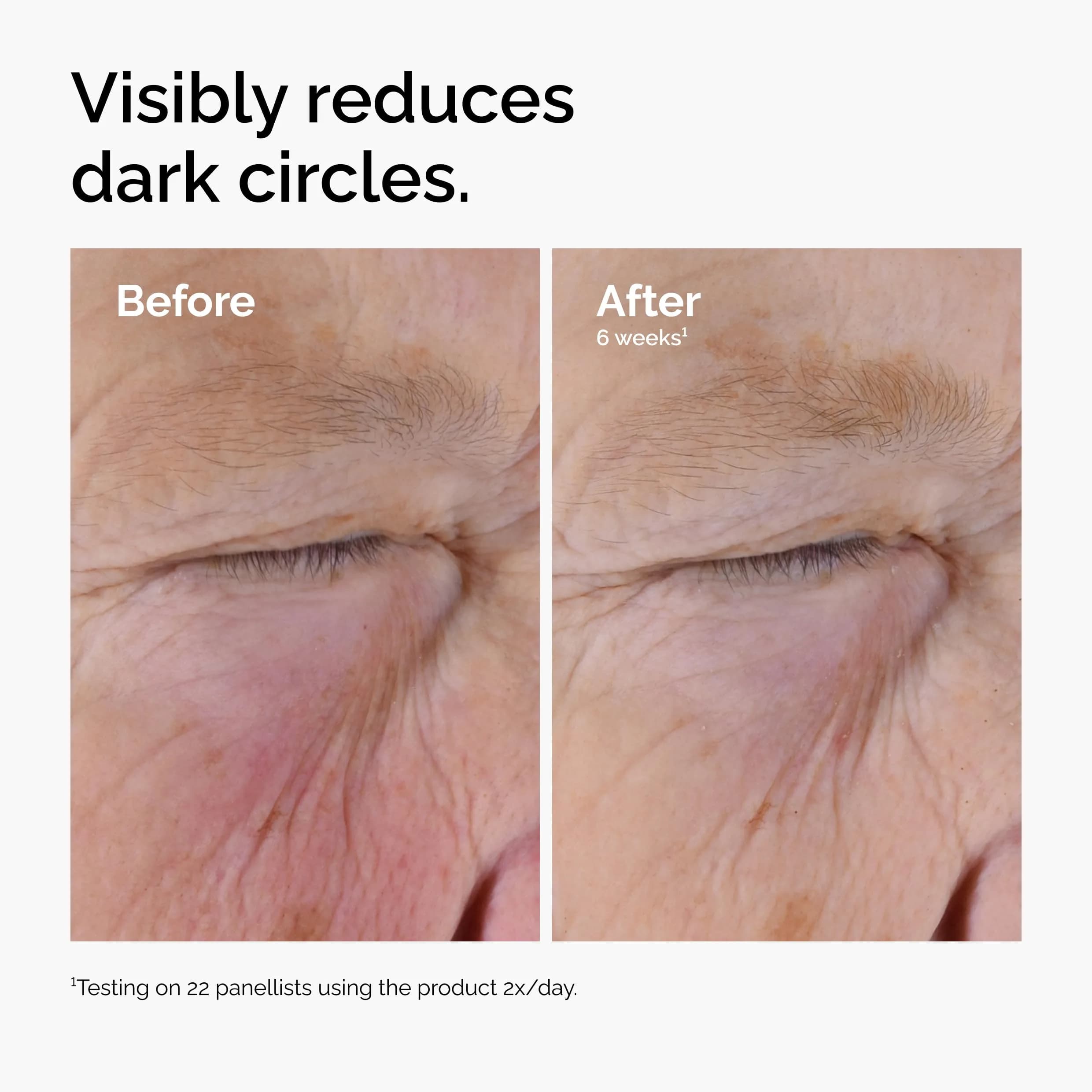 The Ordinary Caffeine Solution 5% + EGCG Eye Serum 30ml (1 Fl Oz) | Reduces Puffiness & Dark Circles - view 5