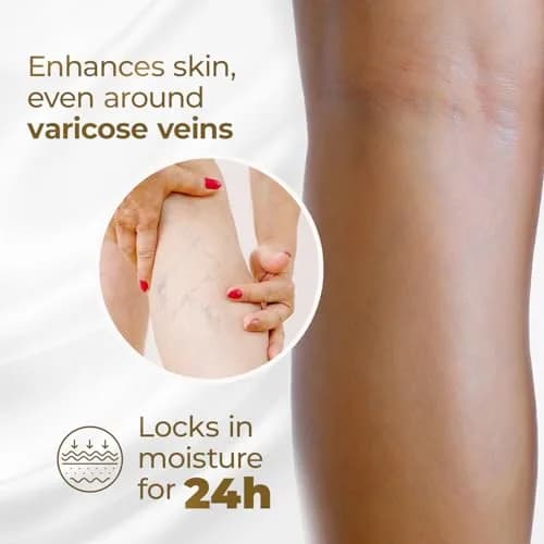 Goicoechea Arnica & Chamomile Body Lotion 13.5 Oz | Supports Leg Comfort & Skin Hydration thumbnail 4