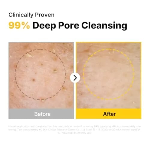 MANYO Pure Cleansing Oil 200ml (6.76 fl oz) | Deep Pore Cleanser for All Skin Types thumbnail 5