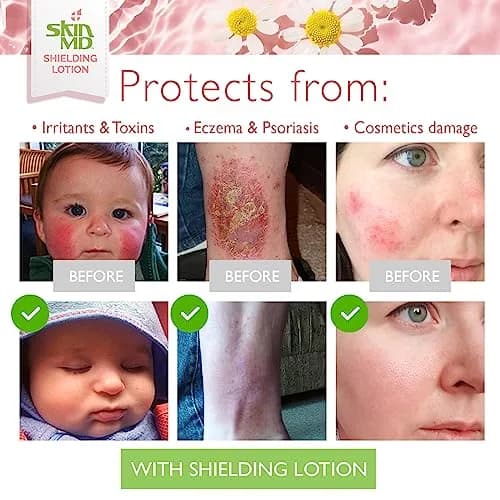 Skin MD Shielding Lotion Hydrating Body Lotion for Sensitive Skin with Dispenser | Non-Greasy, Fast-Absorbing Moisturizer with Plant-Based Ingredients, Eczema & Psoriasis Relief - 8oz 2-Pack thumbnail 5
