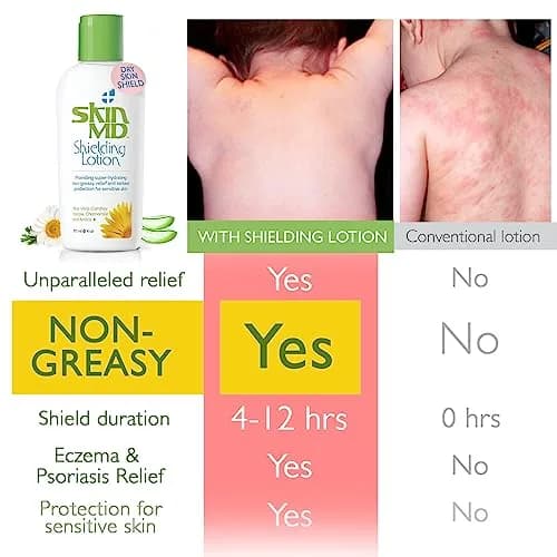 Skin MD Shielding Lotion Hydrating Body Lotion for Sensitive Skin with Dispenser | Non-Greasy, Fast-Absorbing Moisturizer with Plant-Based Ingredients, Eczema & Psoriasis Relief - 8oz 2-Pack thumbnail 2