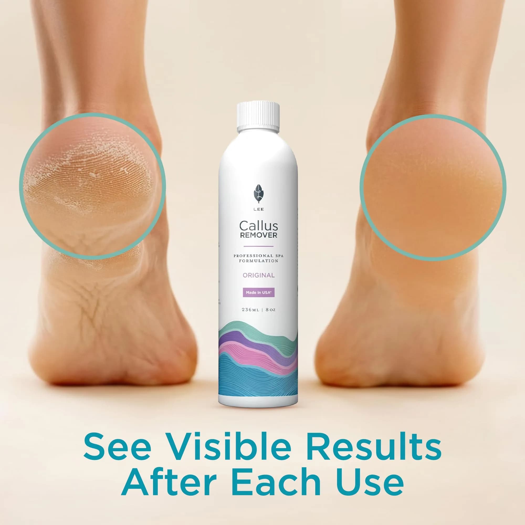 Lee Beauty Professional Gel Callus Remover 237ml (8 Fl Oz) | Fast-Acting Formula for Cracked Heels & Dead Skin - view 4
