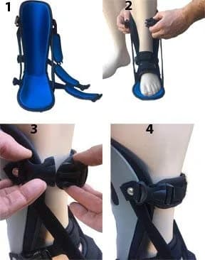 Alpha Medical Plantar Fasciitis Night Splint Small (10 inches L x 7 inches H x 14 inches W) | FDA Approved Foot Pain Brace thumbnail 6