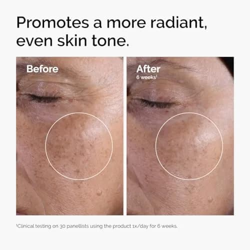 The Ordinary Glycolic Acid 7% Exfoliating Toner for Face, 240ml (8.1 Fl Oz) | Smooths Skin Texture & Evens Tone thumbnail 2