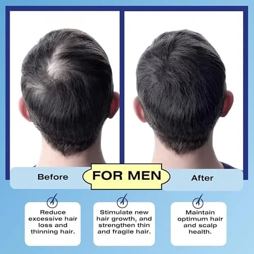 Mediceuticals Follicle Revitalizer 4.23 oz (150 ml) | DHT Blocker for Men & Women, Hair Follicle & Scalp Stimulator thumbnail 5