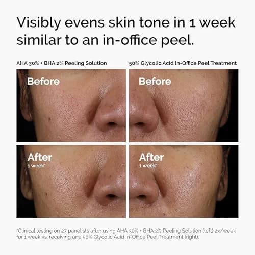 The Ordinary AHA 30% + BHA 2% Peeling Solution for Brighter Skin, 30ml thumbnail 6