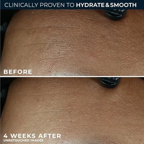 RoC Retinol Correxion Max Daily Hydration Face Moisturizer 50ml (1.7 Fl Oz) | Oil-Free Anti-Aging Cream for Fine Lines thumbnail 4