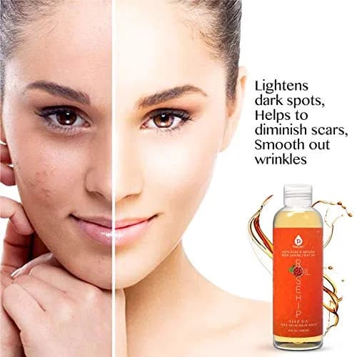 Pursonic Rosehip Seed Oil 6 Fl Oz | Hydrating & Brightening for Dry, Sensitive Skin thumbnail 5