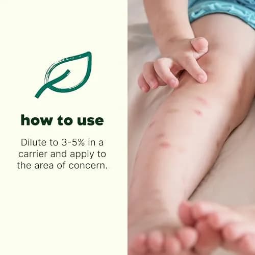Plant Therapy Itch Away Essential Oil Blend 10ml (0.33 Fl Oz) | Soothes Bug Bites & Skin Irritations thumbnail 2