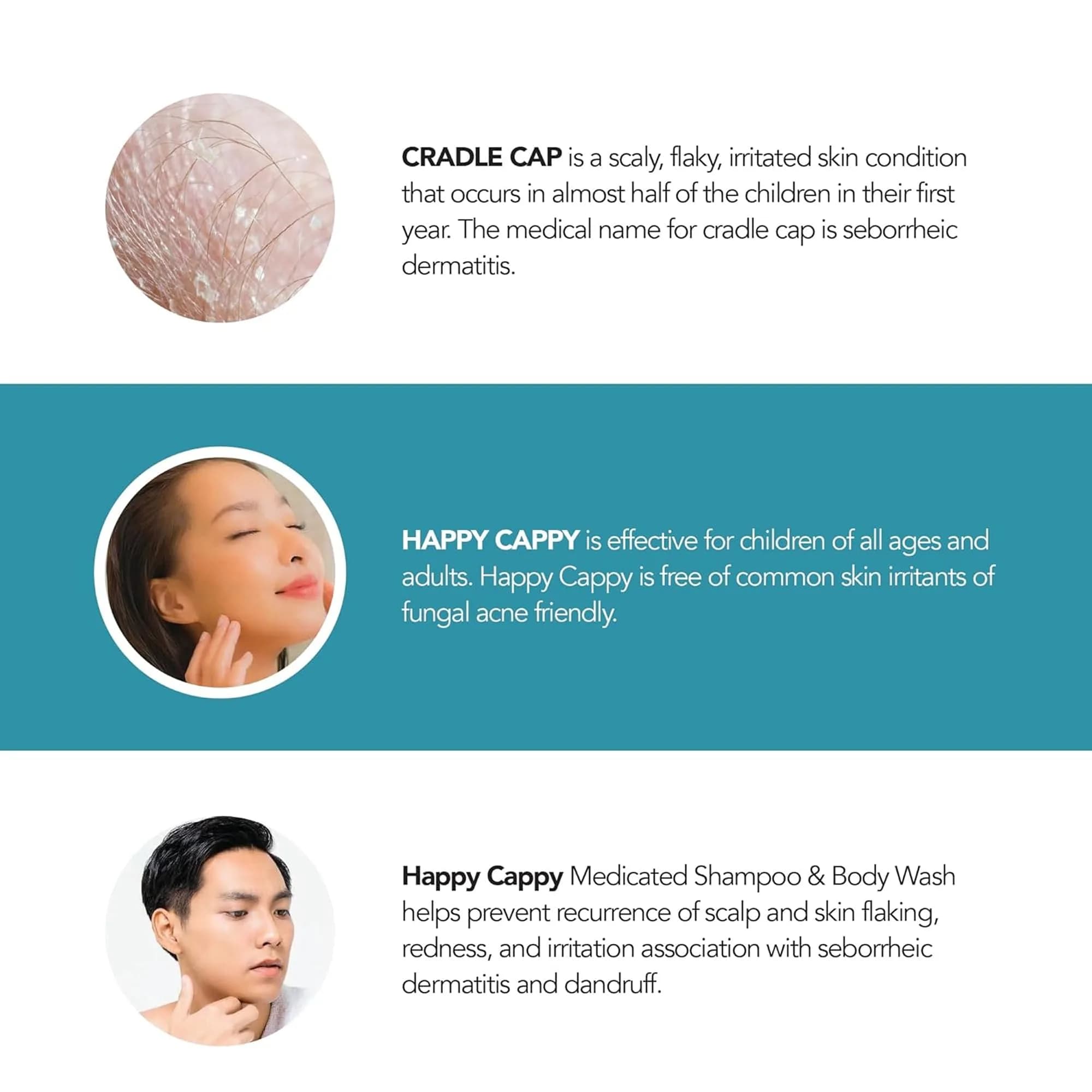 Happy Cappy Medicated Shampoo Only - 8 Fl Oz Bottle for Cradle Cap & Dandruff - view 4