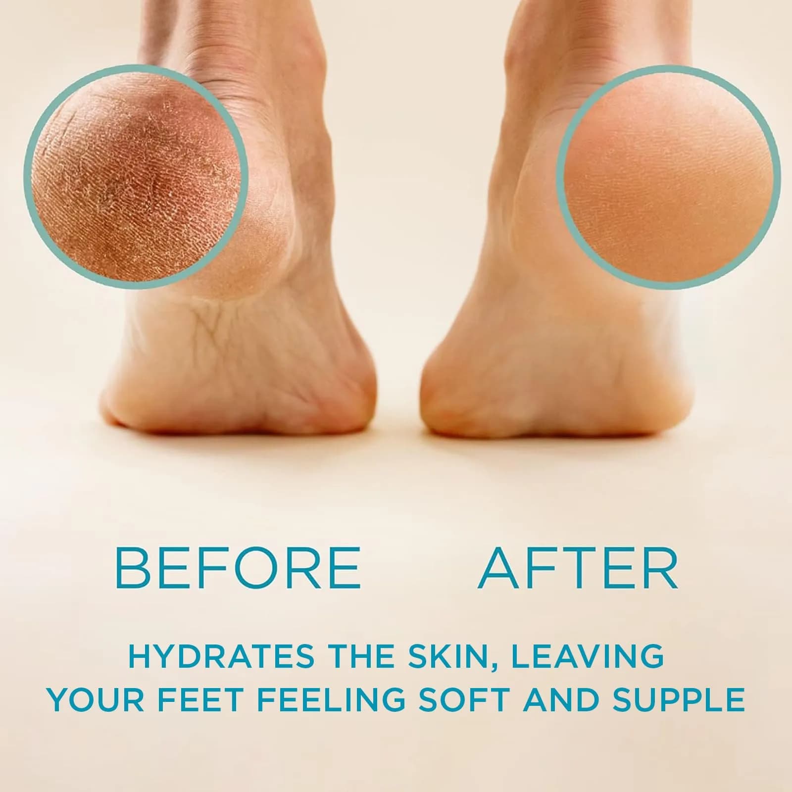 Lee Beauty Professional Gel Callus Remover 8oz (237ml) | Fast-Acting Formula for Smoother Feet - view 2