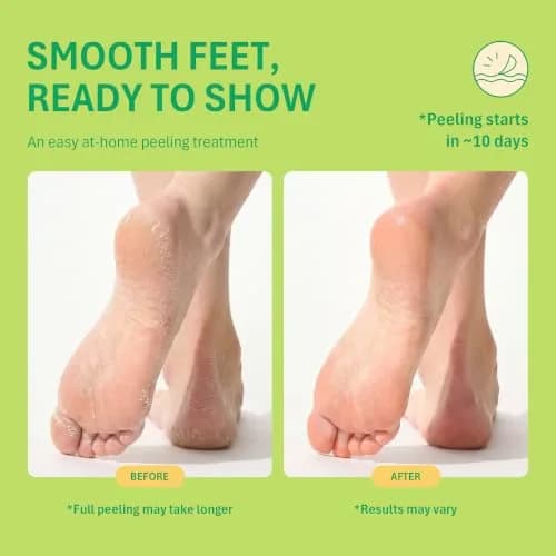 Purederm Foot Peeling Mask for Dry Cracked Feet | Exfoliating & Nourishing Treatment, 6 Pairs thumbnail 3