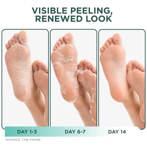 DERMORA Foot Peel Mask, Exfoliating Foot Peeling Mask, 2 Pairs, Original | Gentle Dead Skin Removal for Dry Feet thumbnail 3