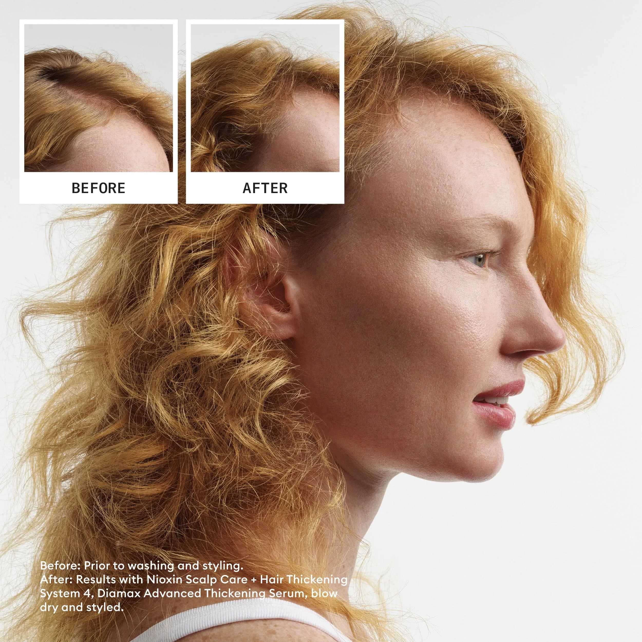 Nioxin System 4 Hair Thickening Treatment | 700ml (23.6 Fl Oz) | For Colored or Damaged Hair with Progressed Thinning - view 2