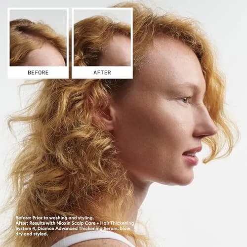Nioxin System 4 Hair Thickening Treatment | 700ml (23.6 Fl Oz) | For Colored or Damaged Hair with Progressed Thinning thumbnail 2