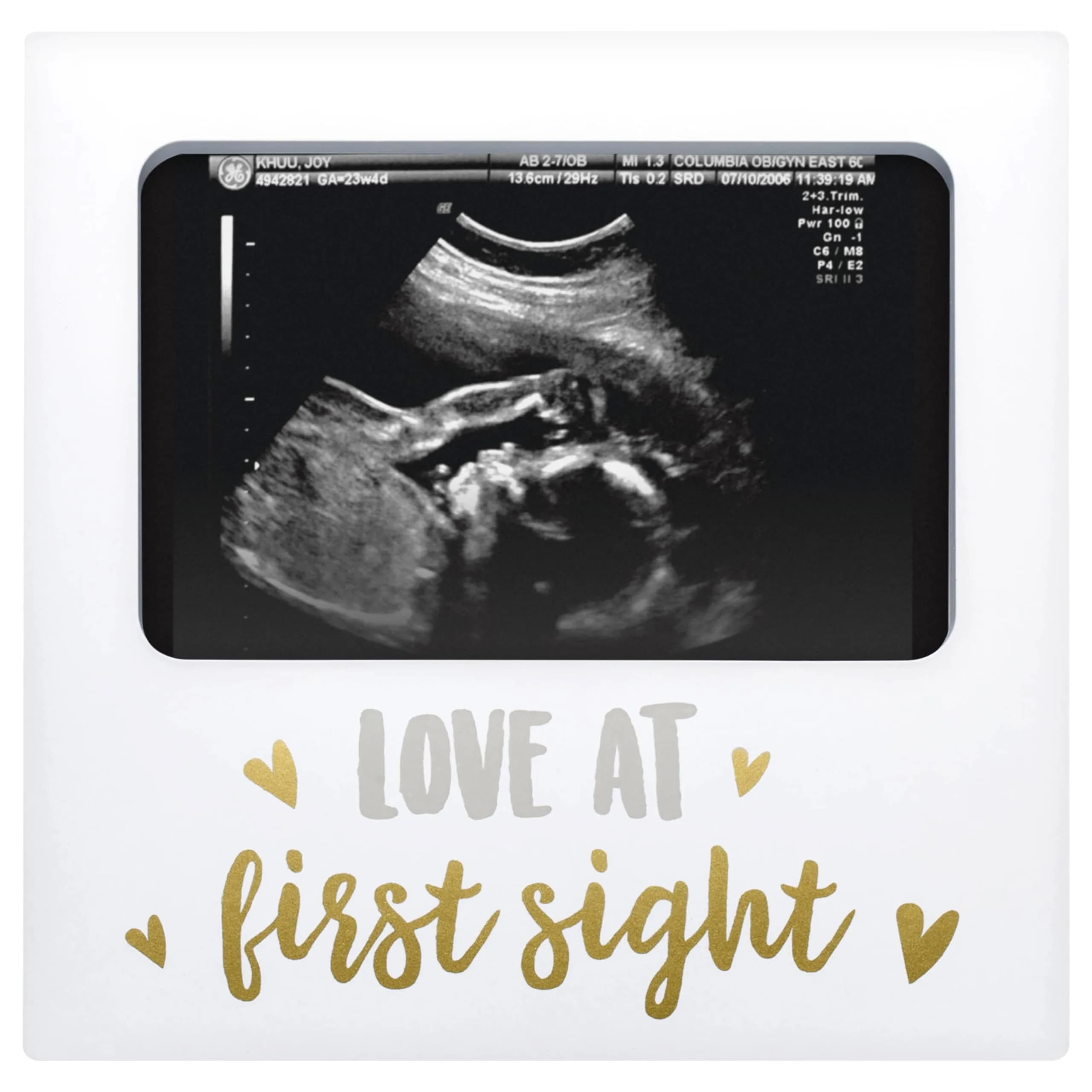 tiny ideas Love at First Sight White Sonogram Keepsake Frame | 4x6 Inch Photo Display for Nursery Decor — Love at First Sight Frame