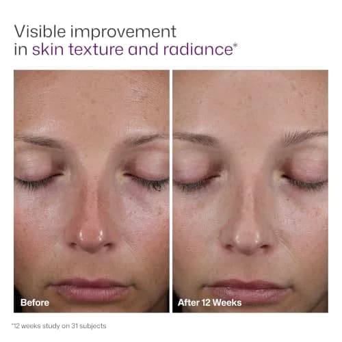 EltaMD UV AOX Elements 100% Mineral Tinted Face Sunscreen SPF 50 | Hydrates & Protects Sensitive Skin thumbnail 9