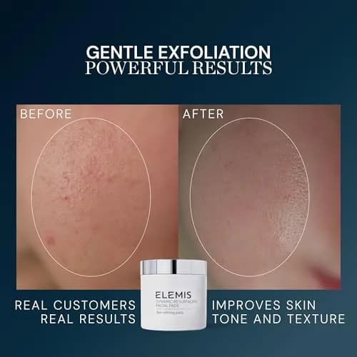 ELEMIS Dynamic Resurfacing Facial Pads, 60 Count | Gentle Textured Treatment for Radiant Skin thumbnail 3