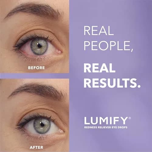 LUMIFY Redness Relief Eye Drops 7.5ml (0.25 Fl Oz) | FDA Approved for Whiter, Brighter Eyes thumbnail 2
