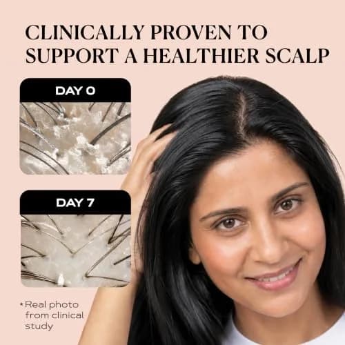 KAMEDIS Scalp Moisturizer Lotion 3.38 Fl Oz | Soothes Dry, Itchy & Sensitive Scalp thumbnail 7