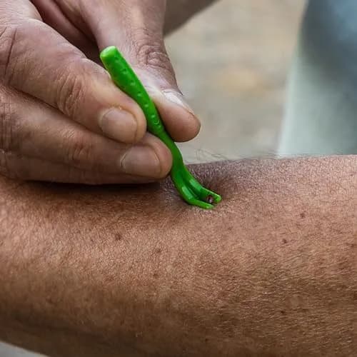 TickCheck Tick Remover Value 3 Pack with ID Card | Easy Tick Removal for Humans, Dogs, Cats & Pets thumbnail 6